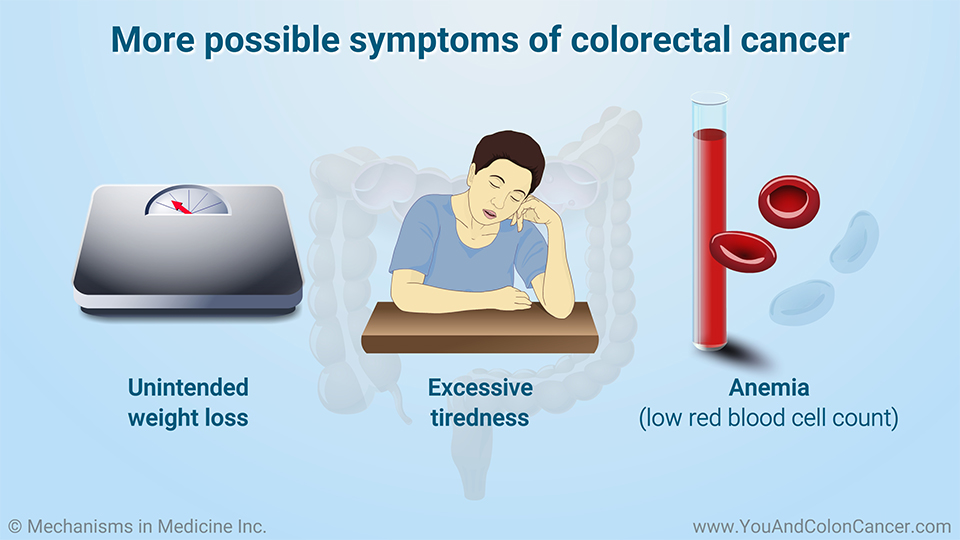 More possible symptoms of colorectal cancer
