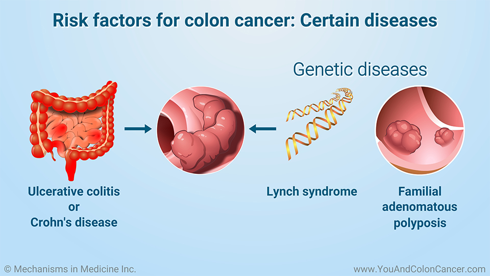 Risk factors for colon cancer: Certain diseases