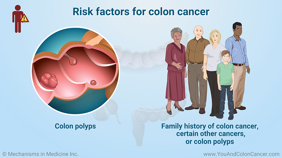 Risk factors for colon cancer