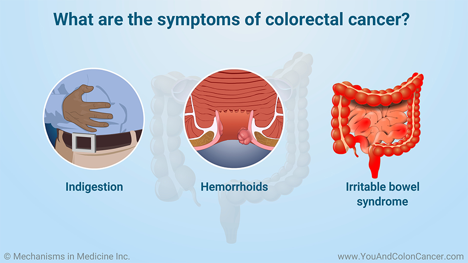 What are the alarm symptoms of colorectal cancer?