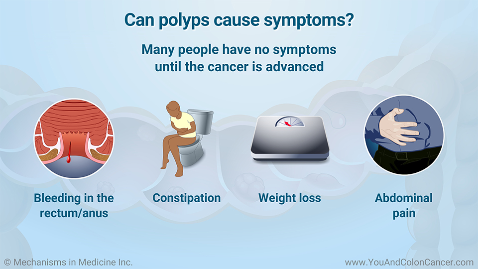 Can polyps cause symptoms?