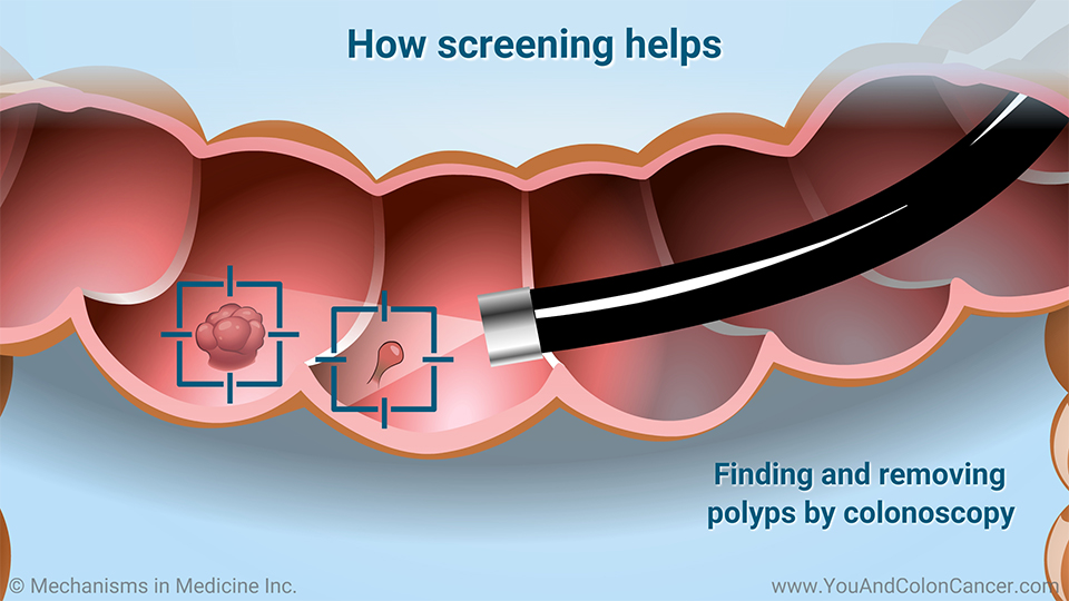 How screening helps